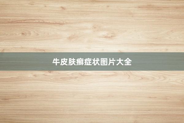 牛皮肤癣症状图片大全